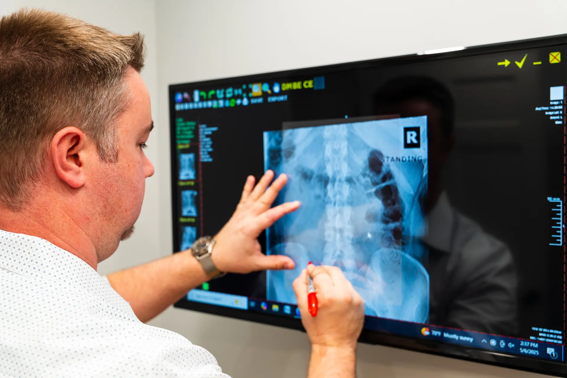 Dr. Joe Sas reviewing a Motion Study X-Ray series of still images at Gateway Chiropractic in St. Louis, MO.